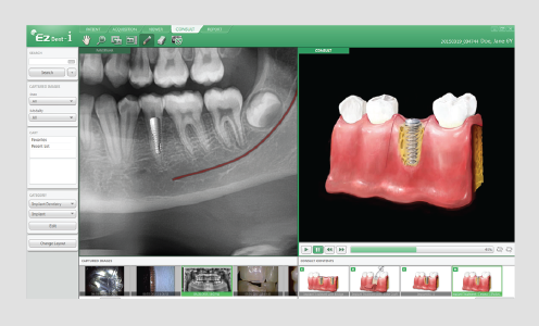 3d dentalni softver vatech