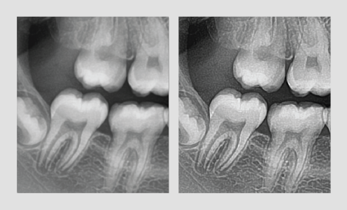 3d dentalni softver kvalitet slika